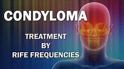Condyloma - RIFE Frequencies Treatment - Energy & Quantum Medicine with Bioresonance
