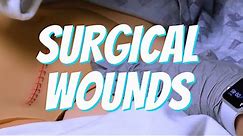 Surgical Wound Care | Nurse Skill Demo