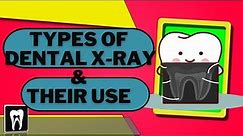 Types of Dental X-rays |Dental Radiographs and Why we use them |Oral Radiology |Types of Radiographs