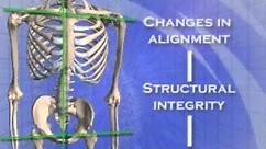 About the Atlas Orthogonal procedure