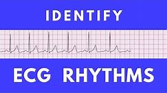 Identifying ECG rhythms | ACLS Precourse