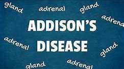 Addison's Disease: 10 Interesting Facts