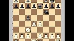 Chess Tactics: Undermining: Colias B vs Ronco J