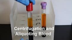 Centrifugation and Aliquoting of Blood Serum and Plasma