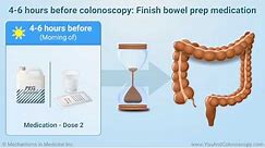 What is a colonoscopy and how do I prepare for it?