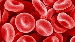 What does being a hemochromatosis carrier mean?