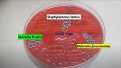 Staphylococcus lentus, Klebsiella pneumoniae and Serratia ficaria on CLED Agar of Urine Culture