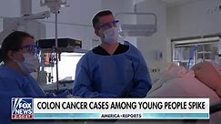 Alarming spike in colon cancer cases among young adults