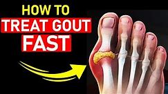 🔥Top 7 Gout Foot & Big Toe HOME Treatments [+1 BIG SECRET]