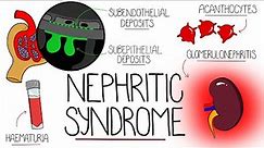 Understanding Nephritic Syndrome (With Pathology Made Easy)