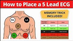 How to Place a 5 Lead ECG: MNEMONIC [Electrode Placement Made Easy] #nursing