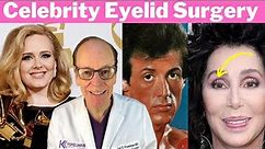 Celebrity Eyelid Surgery | Plastic Surgeon Reacts