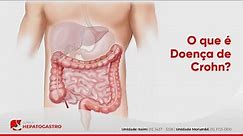 O que é Doença de Crohn? | Clínica Hepatogastro