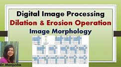 Dilation and Erosion, Opening and Closing : Image morphology