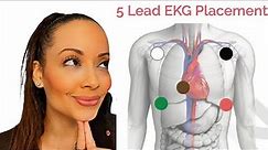 Hack How to Remember 5 lead ECG Placement 5 LEAD ECG RHYME