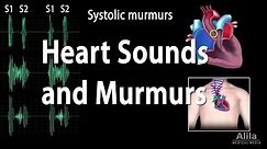 Heart Sounds and Heart Murmurs, Animation.