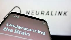 Elon Musk's Neuralink Reportedly Hit With Federal Probe Over Animal Welfare Claims - SlashGear