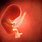 4 Month Embryo