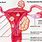 8 Cm Fibroid in Uterus