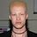 Albino Model Shaun Ross