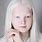 Albino People Eye Color