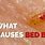 Bed Bug Diseases