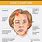 Bell's Palsy Disease