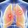 Benign Lung Tumor