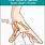 Common Thumb Injuries
