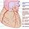 Diagram of Coronary Arteries