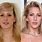 Ellie Goulding Before and After