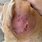Folliculitis in Dogs Pictures