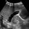Gallbladder Pathology Ultrasound