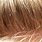 Head Lice in Blonde Hair