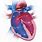 Heart Abnormalities