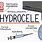 Hydrocele Sac
