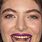 Lorde Teeth