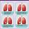 Lung Cancer Tumor Size