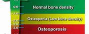 Mayo Clinic Bone Density Chart