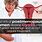 Ovarian Cyst Post Menopausal