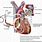 Pulmonary Artery Flow Restrictors