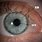 Pupil Eye Anatomy