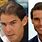 Rafael Nadal Hair Transplant