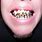 Rotten Teeth After Braces