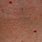 Small Bright Red Dots On Skin