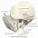 Temporal Bone Lateral View