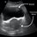 Transabdominal Ultrasound Uterus