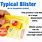 Types of Blister Packaging