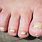 Ugly Foot Nails