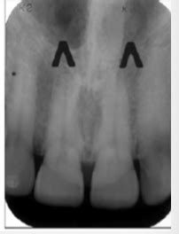 D2 Radiology Lec 5 Flashcards | Quizlet